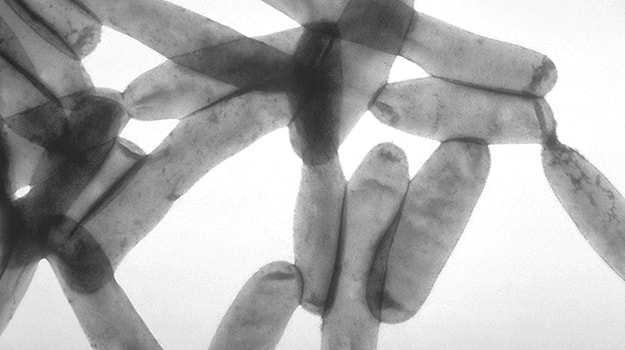 Legionella pod mikroskopem